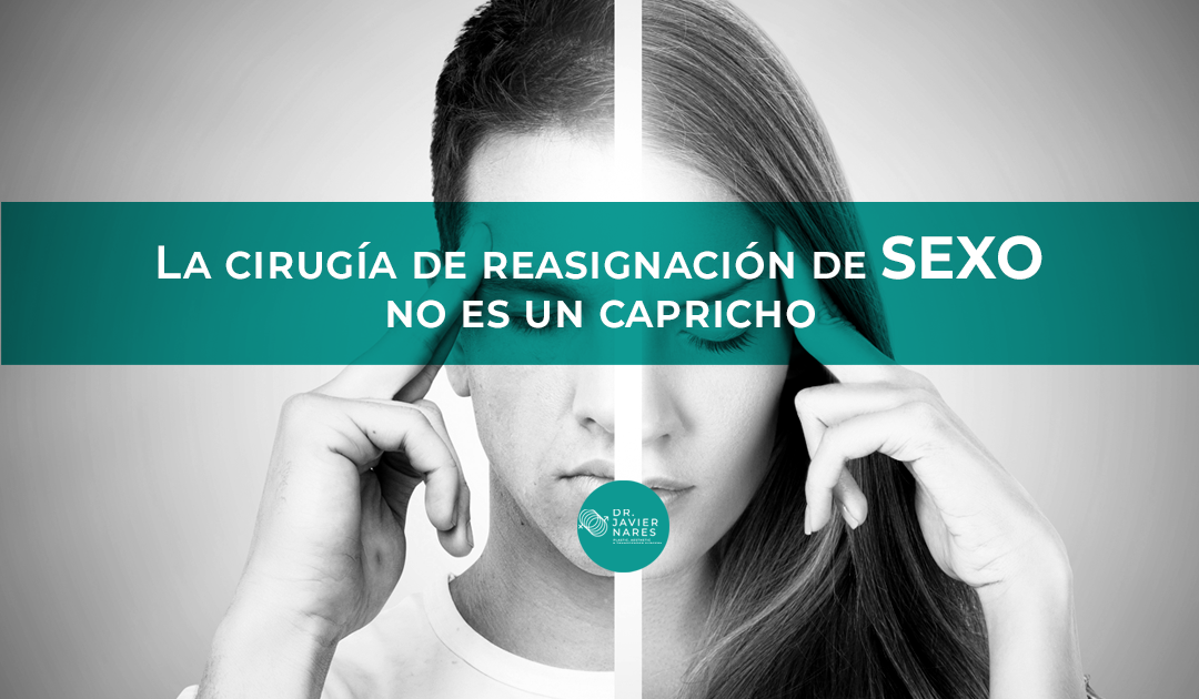 Cirugía de reasignación de sexo